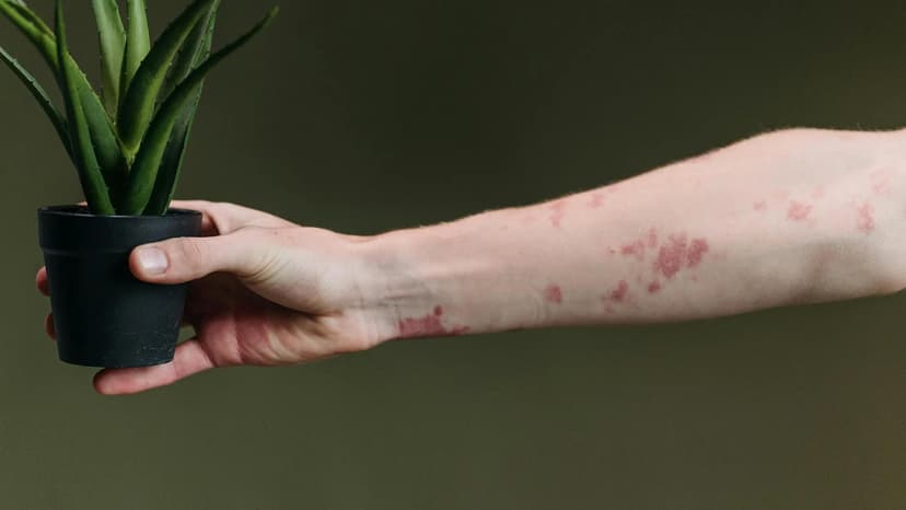 arm with autoimmune rash